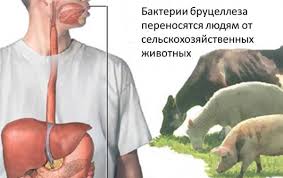 бруцеллез.jpg